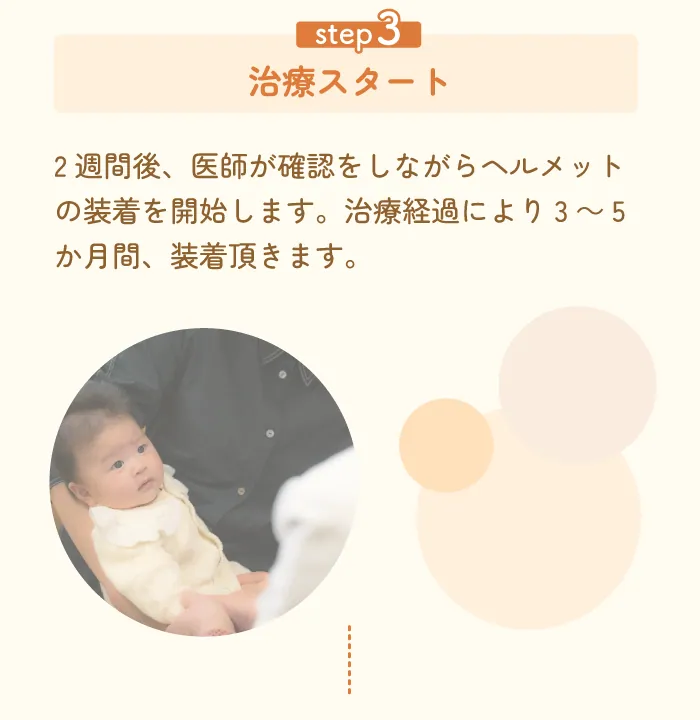 福岡 頭 の 形 外来,頭 の 形 クリニック 福岡,赤ちゃん 頭の形,0 歳 から の 頭 の かたち クリニック 福岡,赤ちゃん 頭の形,ヘルメット 治療 福岡,0 歳からの頭の形クリニック,頭 の 外来,頭の歪み クリニック,ヘルメット 治療,0 歳 から の 頭 の かたち クリニック,乳児 頭 の 形 外来,赤ちゃん 頭 の 歪み 治し 方,頭の形 クリニック,頭 の かたち クリニック,福岡 ヘルメット 治療,ヘルメット 治療 費用,頭 矯正,新生児 頭 矯正,赤ちゃん 頭の形 外来 福岡,赤ちゃん 頭 の 形 福岡,新生児 絶壁 治し 方,ヘルメット 治療,ヘルメット 乳児,ゼロ 歳 から の 頭 の 形 クリニック,頭 の 形 を 治す,赤ちゃん 頭 の 形 矯正,赤ちゃん 頭 の 歪み 病院,頭 の 形 矯正,絶壁 治す 方法,0 歳 から の 頭 の 形 クリニック 口コミ,子供 の 頭 の 形 矯正,赤ちゃん 頭 の 歪み,斜 頭 矯正,絶壁 治し 方,赤ちゃん 頭 の 形 矯正 ヘルメット,頭 の 形 矯正 いつまで,赤ちゃん 絶壁 治る,赤ちゃん ヘルメット 治療,頭 の 形 外来 福岡,頭 絶壁 治療,生後 3 ヶ月 絶壁 治し 方,あ たま の かたち 外来,赤ちゃん 向き 癖 矯正,ヘルメット 矯正 値段,頭 の 形 ヘルメット 値段,赤ちゃん 頭 ヘルメット,ヘルメット 絶壁,斜 頭 症,新生児 向き 癖 治し 方,頭 の 形 赤ちゃん,頭 の 形 治療,赤ちゃん 向き 癖 を 治す 方法,乳児 頭 矯正 ヘルメット,赤ちゃん 矯正 ヘルメット,頭 の かたち クリニック,赤ちゃん 頭 長い いつ 治る,斜 頭 病院,0 歳 から の 頭 の かたち クリニック レビュー,絶壁 治る,赤ちゃん 頭 の 形 ヘルメット 費用,ヘルメット ベビー