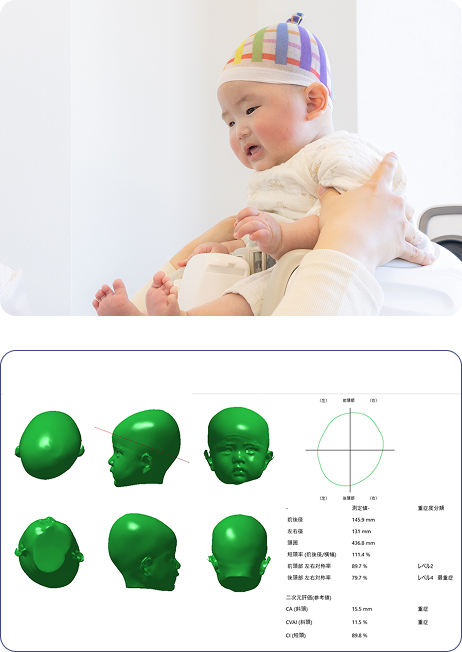3Dスキャンデータに基づく「完全オーダーメイド」設計